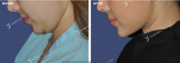 neck contouring1 (1)[4].png (600×211)